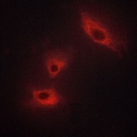 ACVR1B Rabbit Polyclonal Antibody