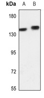 Adenylate Cyclase 5/6 Rabbit Polyclonal Antibody