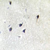 Adenylate Cyclase 5/6 Rabbit Polyclonal Antibody