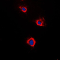 Adenylate Cyclase 5/6 Rabbit Polyclonal Antibody