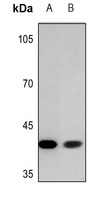 ADH7 Rabbit Polyclonal Antibody