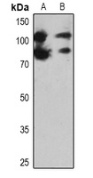 PARP1 Rabbit Polyclonal Antibody