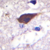 Beta-2 Adrenergic Receptor (Phospho-S346) Antibody