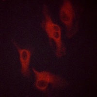 Beta-2 Adrenergic Receptor (Phospho-S346) Antibody