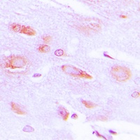 GRK2 (Phospho-S29) Antibody