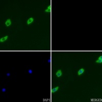 GRK2 (Phospho-S29) Antibody