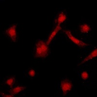 GRK2 Rabbit Polyclonal Antibody