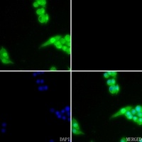 AKT (Phospho-S473) Antibody