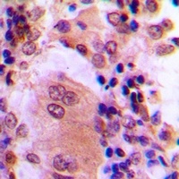 AKT (Phospho-T308) Antibody