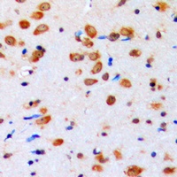 AKT (Phospho-Y315) Antibody
