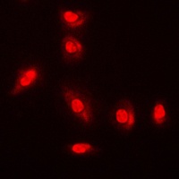 AKT (Phospho-Y315) Antibody