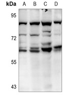 AKT2 Rabbit Polyclonal Antibody