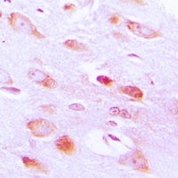 AKT2 Rabbit Polyclonal Antibody