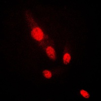 AKT2 Rabbit Polyclonal Antibody
