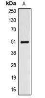 ALDH3A1 Rabbit Polyclonal Antibody