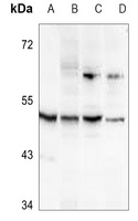 ALDH3B2 Rabbit Polyclonal Antibody