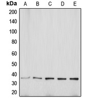 Aquaporin 5 Rabbit Polyclonal Antibody