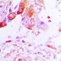 Aquaporin 5 Rabbit Polyclonal Antibody