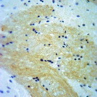 A-RAF (Phospho-Y302) Antibody