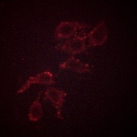 A-RAF (Phospho-Y302) Antibody