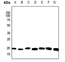 ARF6 Antibody