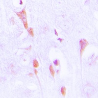 Beta-arrestin-1 (Phospho-S412) Antibody