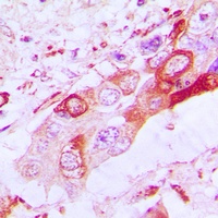 BAK Antibody