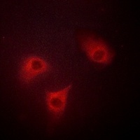 BAK Antibody