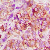 BAX Antibody