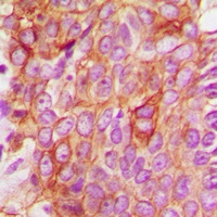 BAX Antibody