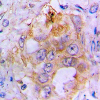 BMP3 Rabbit Polyclonal Antibody
