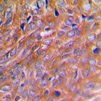 BNIP2 Rabbit Polyclonal Antibody