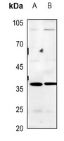 BNIP2 Rabbit Polyclonal Antibody