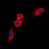 BNIP2 Rabbit Polyclonal Antibody