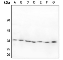 ZFP36L1 Rabbit Polyclonal Antibody