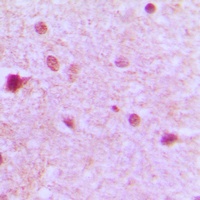 ZFP36L1 Rabbit Polyclonal Antibody