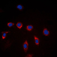 CD157 Rabbit Polyclonal Antibody