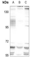 Complement C9 Rabbit Polyclonal Antibody