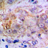 Carbonic Anhydrase 2 Rabbit Polyclonal Antibody