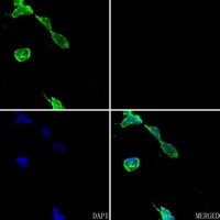 Carbonic Anhydrase 9 Rabbit Polyclonal Antibody