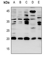 CACNG1 Rabbit Polyclonal Antibody