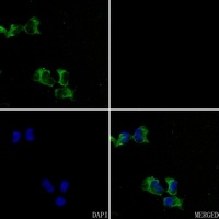 CACNG1 Rabbit Polyclonal Antibody