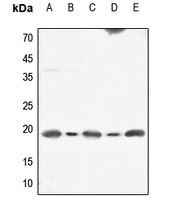 Calmodulin Rabbit Polyclonal Antibody