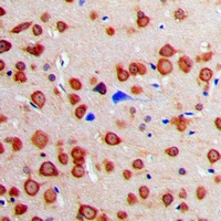 Calmodulin Rabbit Polyclonal Antibody