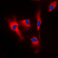 Calmodulin Rabbit Polyclonal Antibody