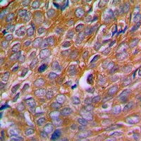 Calnexin (Phospho-S583) Antibody