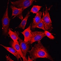 Caspase 1 Rabbit Polyclonal Antibody