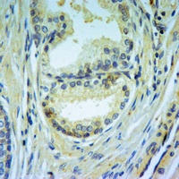 Caspase 3 Rabbit Polyclonal Antibody