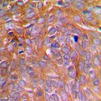 Caspase 8 (Phospho-S347) Antibody