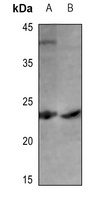 Cerebellin 1 Rabbit Polyclonal Antibody